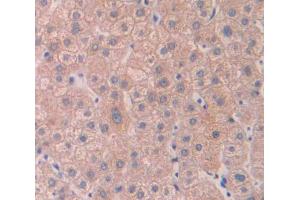 Used in DAB staining on fromalin fixed paraffin- embedded Kidney tissue (Cytohesin 4 antibody  (AA 1-379))