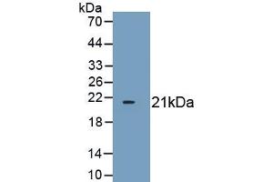 Detection of Recombinant CDKN1A, Mouse using Polyclonal Antibody to Cyclin Dependent Kinase Inhibitor 1A (CDKN1A) (p21 antibody  (AA 2-159))