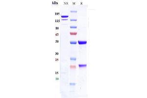 Anti-ICAM1 / CD54 Reference Antibody (bersanlimab) on SDS-PAGE under reducing (R) condition. (Recombinant ICAM1 (Bersanlimab Biosimilar) antibody)