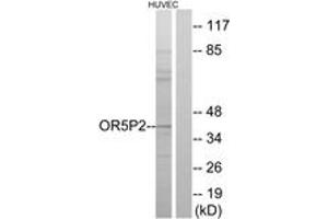 Western blot analysis of extracts from HuvEc cells, using OR5P2 Antibody. (OR5P2 antibody  (AA 193-242))