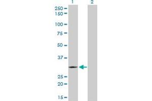 Western Blotting (WB) image for anti-T-Cell Leukemia Homeobox 3 (TLX3) (AA 192-291) antibody (ABIN565459)