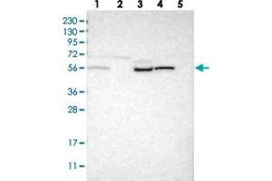 Western blot analysis of Lane 1: RT-4, Lane 2: U-251 MG, Lane 3: Human Plasma, Lane 4: Liver, Lane 5: Tonsil with PIEZO2 polyclonal antibody .