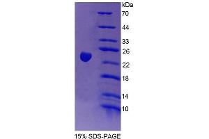 SDS-PAGE analysis of Human Vav 3 Oncogene Protein.