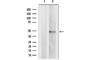 anti-TAR (HIV-1) RNA Binding Protein 2 Pseudogene (TARBP2P) (Internal Region) antibody