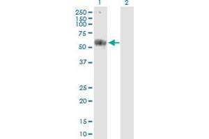 Western Blot analysis of CARD9 expression in transfected 293T cell line by CARD9 MaxPab polyclonal antibody. (CARD9 antibody  (AA 1-492))
