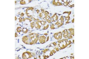 Immunohistochemistry of paraffin-embedded human stomach using VAPA antibody (ABIN6132892, ABIN6150056, ABIN6150057 and ABIN6216758) at dilution of 1:100 (40x lens). (VAPA antibody  (AA 137-227))