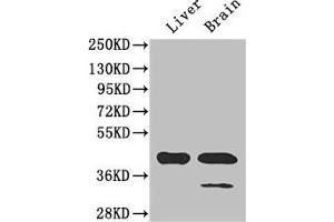 Western Blot Positive WB detected in: Mouse liver tissue, Mouse brain tissue All lanes: GLUL antibody at 3 μg/mL Secondary Goat polyclonal to rabbit IgG at 1/50000 dilution Predicted band size: 42 kDa Observed band size: 42 kDa (GLUL antibody  (AA 86-373))