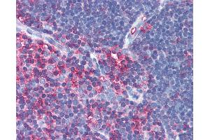 Anti-MSN / Moesin antibody IHC of human thymus. (Moesin antibody)