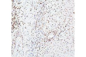 IHC analysis of CRB1 using anti-CRB1 antibody (ABIN6719658). (CRB1 antibody)