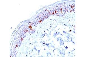 IHC testing of human skin stained with CD1a antibody (O10). (CD1a antibody)