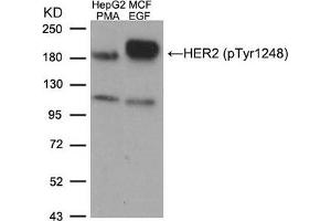 Western blot analysis of extracts from HepG2 cells treated with PMA and MCF cells treated with EGF, using HER2 (Phospho-Tyr1248) Antibody.