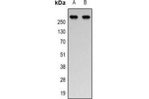 Western blot analysis of p300 (AcK1558/K1560) expression in Jurkat (A), HEK293T (B) whole cell lysates. (p300 antibody  (acLys1558, acLys1560))