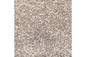 IHC analysis of SNRNP27 using anti-SNRNP27 antibody (ABIN7599614). (SNRNP27 antibody  (AA 100-155))