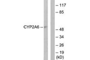 Western blot analysis of extracts from Jurkat cells, using Cytochrome P450 2A6 Antibody. (CYP2A6 antibody  (AA 1-50))