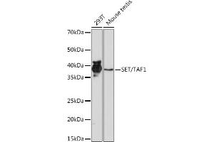 Western blot analysis of extracts of various cell lines, using SET/T Rabbit mAb (ABIN7270265) at 1:1000 dilution. (SET/TAF-I antibody)