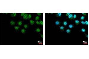 ICC/IF Image LIMD1 antibody [C2C3], C-term detects LIMD1 protein at cytoplasm and nucleus by immunofluorescent analysis.