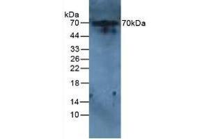 Detection of IL6R in Rat Liver Tissue using Polyclonal Antibody to Interleukin 6 Receptor (IL6R) (IL-6 Receptor antibody  (AA 385-462))