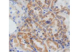 IHC-P analysis of kidney tissue, with DAB staining. (CISH antibody  (AA 1-258))