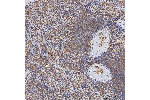 IHC analysis of Syntenin 2/SDCBP2 using anti-Syntenin 2/SDCBP2 antibody (ABIN7600017). (SDCBP2 antibody  (AA 14-292))