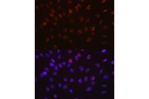Immunofluorescence analysis of C6 cells using Aurora B antibody (ABIN7265782). (Aurora Kinase B antibody)