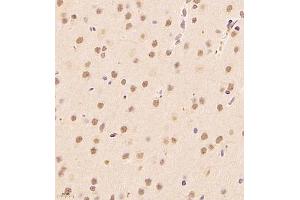 Immunohistochemistry of paraffin embedded rat brain using ALS2CR13 (ABIN7073909) at dilution of 1:1800 (400x lens) (FAM117B antibody)