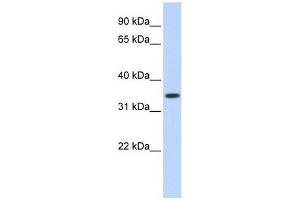 TRIM27 antibody used at 0. (TRIM27 antibody  (Middle Region))