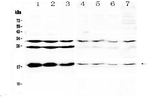 Western blot analysis of TSLP using anti-TSLP antibody .