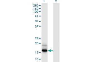 Western Blot analysis of PFDN4 expression in transfected 293T cell line by PFDN4 monoclonal antibody (M03), clone 2G4.