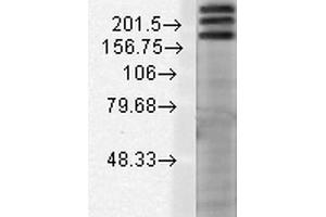 Western Blot analysis of Rat brain membrane lysate showing detection of SHANK1 protein using Mouse Anti-SHANK1 Monoclonal Antibody, Clone S22-21 . (SHANK1 antibody  (AA 469-691) (APC))