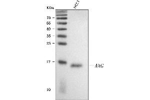 Western blot analysis of Angiogenin/ANG using anti-Angiogenin/ANG antibody (ABIN4886457).