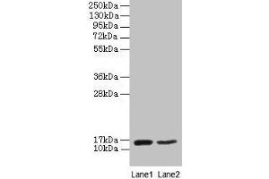 Western blot All lanes: CD59 antibody at 2 μg/mL Lane 1: Mouse heart tissue Lane 2: NIH/3T3 whole cell lysate Secondary Goat polyclonal to rabbit IgG at 1/10000 dilution Predicted band size: 15 kDa Observed band size: 15 kDa (CD59 antibody  (AA 26-102))