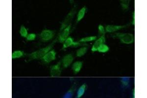 Immunofluorescence analysis of NIH-3T3 cells using FDFT1 Polyclonal Antibody at dilution of 1:100. (FDFT1 antibody)