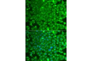 Immunofluorescence analysis of A549 cells using KBTBD7 antibody (ABIN5975133). (KBTBD7 antibody)