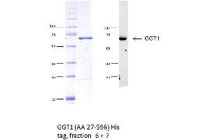 Western Blotting (WB) image for gamma Glutamyltransferase 1 (GGT1) (AA 27-569) protein (His tag) (ABIN3092760) (GGT1 Protein (AA 27-569) (His tag))