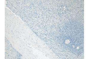 (ABIN334402) Negative Control showing staining of paraffin embedded Human Spleen, with no primary antibody. (FTL antibody  (C-Term))