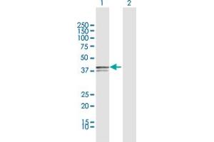 Western Blotting (WB) image for anti-X-Ray Repair Complementing Defective Repair in Chinese Hamster Cells 3 (XRCC3) (AA 1-346) antibody (ABIN521428)