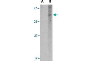 Western blot analysis of NANOS1 in SK-N-SH cell lysate with NANOS1 polyclonal antibody  at 1 ug/mL in (A) the presence and (B) the absence of blocking peptide. (Nanos Homolog 1 antibody  (N-Term))