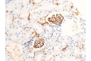 Immunohistochemistry (IHC) image for anti-Checkpoint Kinase 1 (CHEK1) (pSer286) antibody (ABIN6255167)
