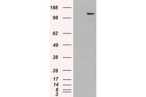 HEK293T cells were transfected with the pCMV6-ENTRY control (Left lane) or pCMV6-ENTRY L1CAM (Right lane) cDNA for 48 hrs and lysed. (L1CAM antibody)