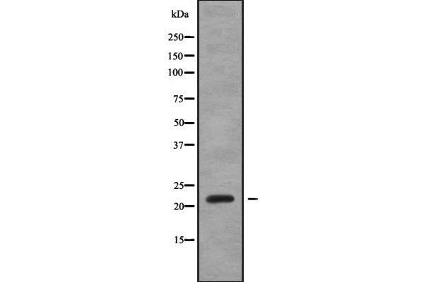 SAR1A antibody  (Internal Region)