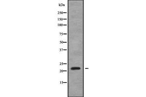 Western blot analysis SAR1A using HeLa whole cell lysates (SAR1A antibody  (Internal Region))
