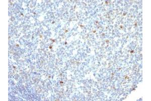 Image no. 2 for Mouse anti-Human IgM antibody (ABIN6155086) (Mouse anti-Human IgM Antibody)