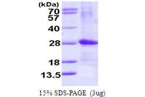 SDS-PAGE (SDS) image for ADP-Ribosylation Factor-Like 4D (ARL4D) (AA 1-201) protein (His tag) (ABIN667588) (ARL4D Protein (AA 1-201) (His tag))