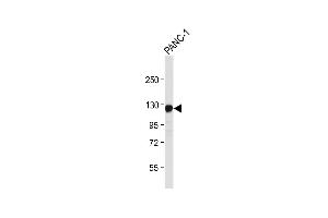 Anti-ROR1 Antibody at 1:4000 dilution + NC-1 whole cell lysate Lysates/proteins at 20 μg per lane. (ROR1 antibody)