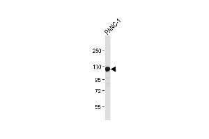 Anti-ROR1 Antibody at 1:4000 dilution + NC-1 whole cell lysate Lysates/proteins at 20 μg per lane.