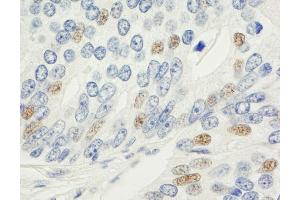 Immunohistochemistry (IHC) image for anti-Proteasome (Prosome, Macropain) 26S Subunit, Non-ATPase, 14 (PSMD14) (AA 1-50) antibody (ABIN7454613)