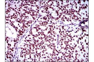 Immunohistochemistry (IHC) image for anti-Ring Finger Protein 1 (RING1) (AA 79-263) antibody (ABIN1845880) (RING1 antibody  (AA 79-263))