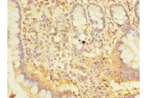Immunohistochemistry of paraffin-embedded human small intestine tissue using ABIN7170402 at dilution of 1:100 (SNX6 antibody  (AA 1-290))