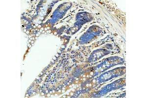 IHC analysis of GIP using anti-GIP antibody (ABIN4886602).