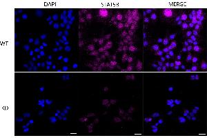Immunocytochemical staining of Hela cells using STAT5B antibody (ABIN7800348), 1:1,000), Top panel: wild-type (WT), Bottom panal: STAT5B shRNA knockdown (KD). (Recombinant STAT5B antibody)